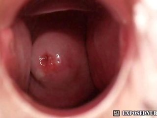 Enfermeira zaneta espéculo masturbação em clínica